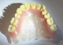 dentures