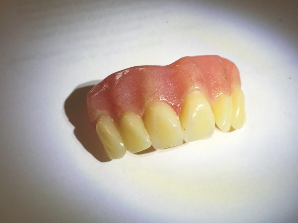 dentures
