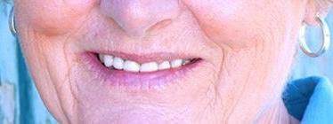smile